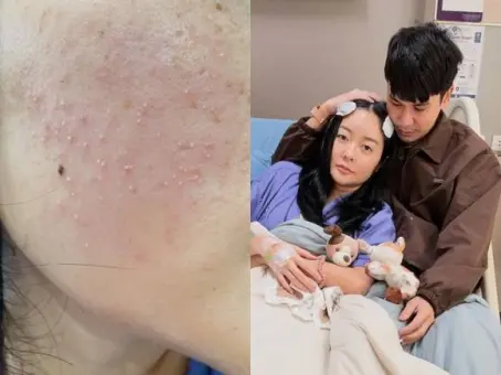 แก้มบุ๋ม โพสต์อาการล่าสุดหลังจากสูญเสียลูกในท้อง ติดเชื้อในกระแสเลือด ต้องพักต่อ
